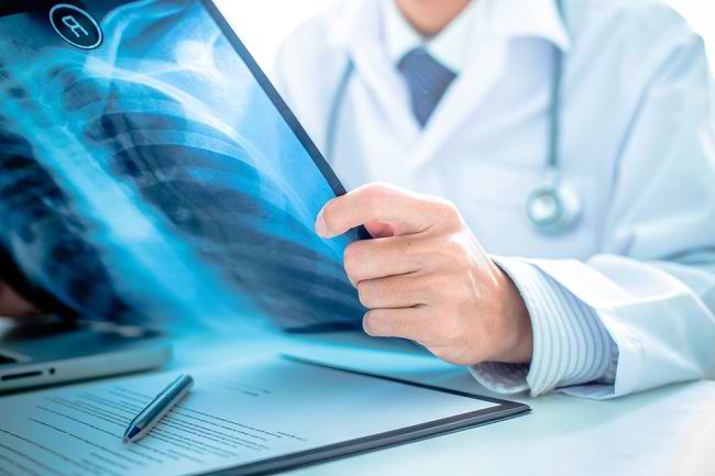 Memahami Peran Dokter Paru di Sini - Alodokter
