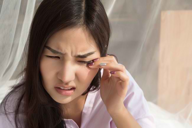 Yuk, Hentikan Kebiasaan Mengucek Mata agar Tidak Terkena Dampak Negatifnya - Alodokter