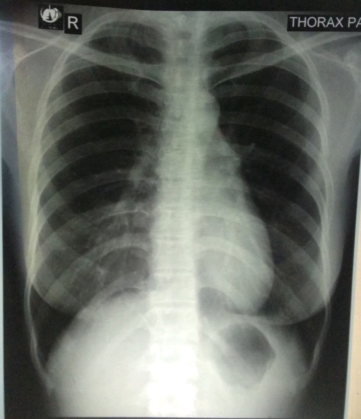 Ariel bilan multfilm jinsiy aloqa Reychel Weisz jinsiy aloqa video