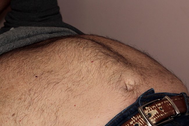 alodokter-hernia
