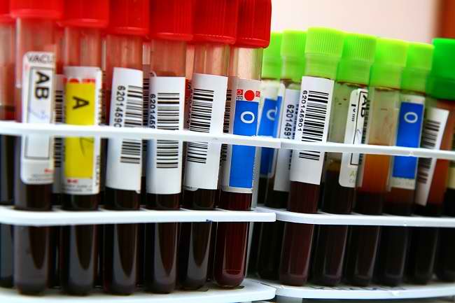 Memahami Karakteristik Golongan Darah A, B, AB, dan O - Alodokter