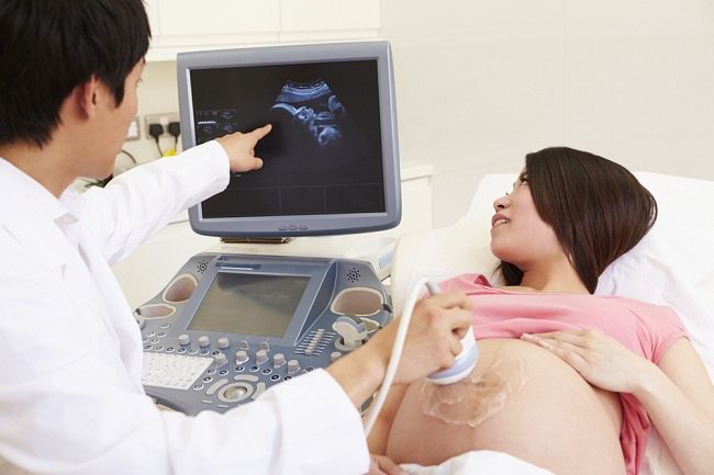 Lebih Jauh Tentang USG - Alodokter