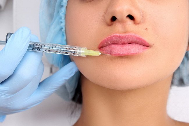 6 Jenis Suntik Filler untuk Kulit Wajah Awet Muda - Alodokter