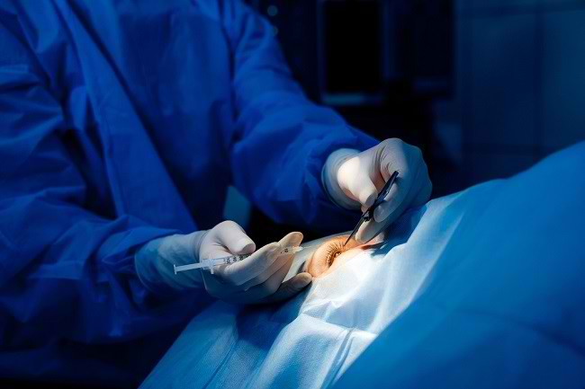 Serba-Serbi Operasi Mata Juling - Alodokter