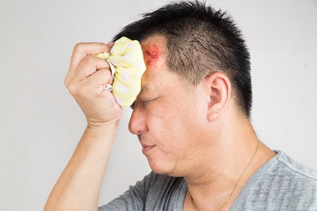 alodokter-trauma-kepala-ringan