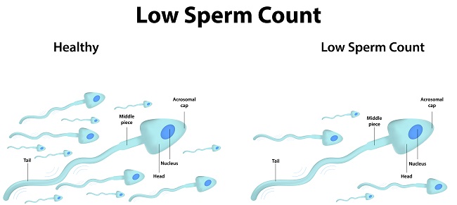 Diagnosis Oligospermia Alomedika diagnosis-oligospermia-alomedika