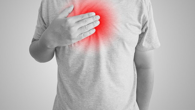 Esophagitis - alodokter