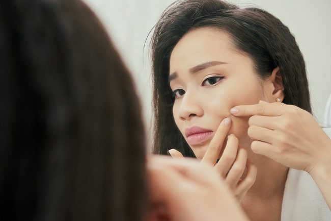 Can't resist Squeezing Pimples?  This is the solution!  - Alodokter