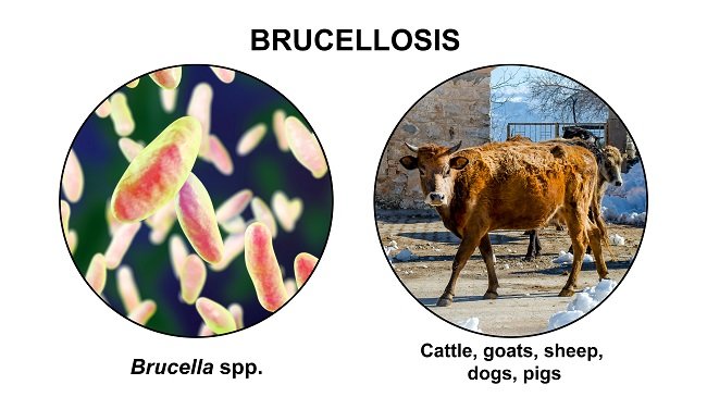 Brucellosis - alodokter