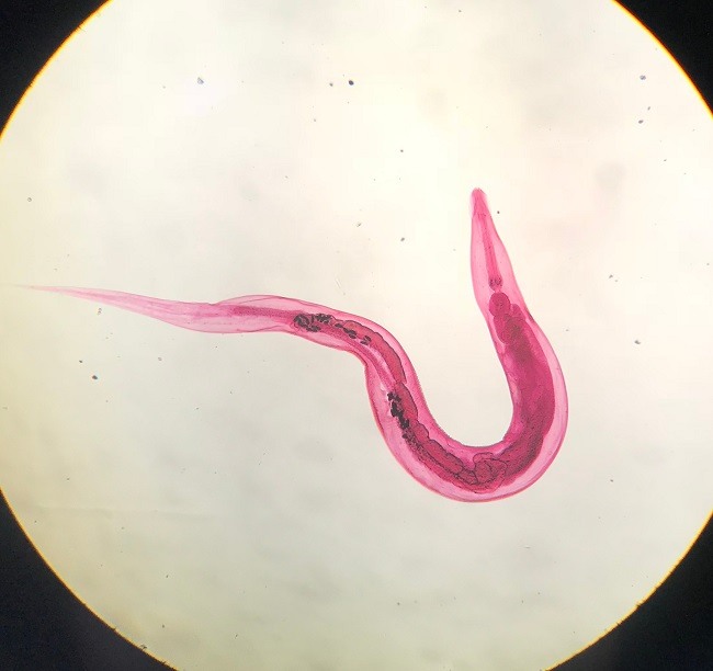 Threadworms - alodokter