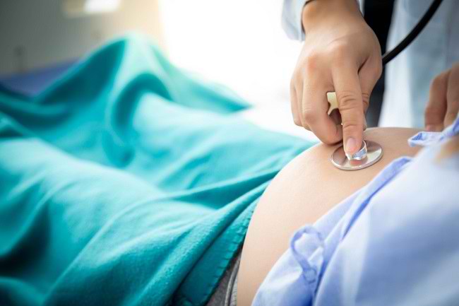 Risiko Posisi Litotomi Ketika dalam Proses Persalinan - Alodokter