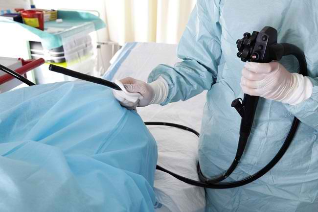 Khawatir Kanker Usus? Lakukan Kolonoskopi - Alodokter