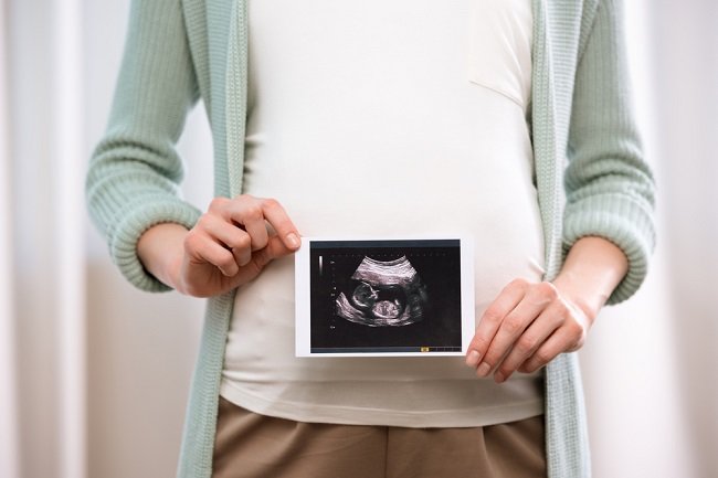 Aspirasi Mekonium: Penyebab Bayi Keracunan Air Ketuban - Alodokter