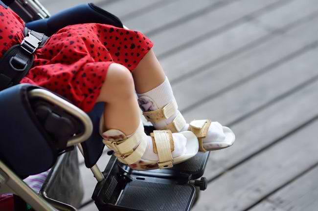 Mengenal Distrofi Otot: Kelainan pada Otot yang Mengancam Nyawa - Alodokter