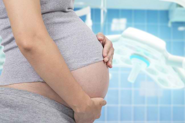Bolehkah Operasi Caesar Dilakukan atas Permintaan Pasien? - Alodokter