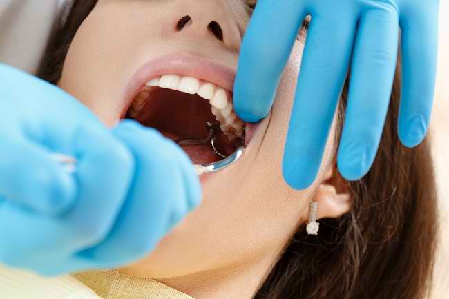 Ketahui Hal-hal yang Berkaitan dengan Cabut Gigi - Alodokter