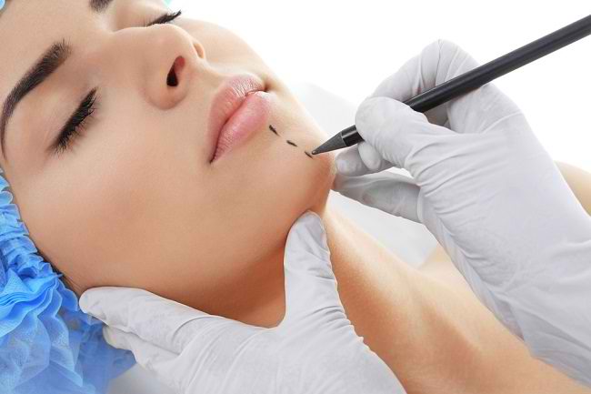 Things You Need to Know Before Undergoing Plastic Surgery - Alodokter