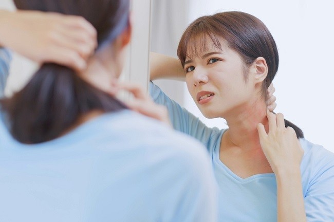 Penyebab Jerawat di Leher dan Pilihan Cara Mengatasinya - Alodokter