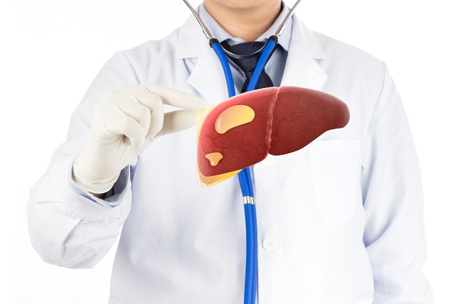 perlemakan hati - alodokter