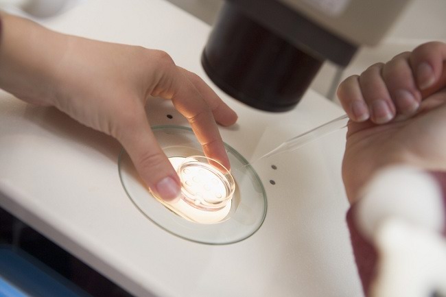 Hal Hal Yang Perlu Diketahui Mengenai Donor Sperma Alodokter