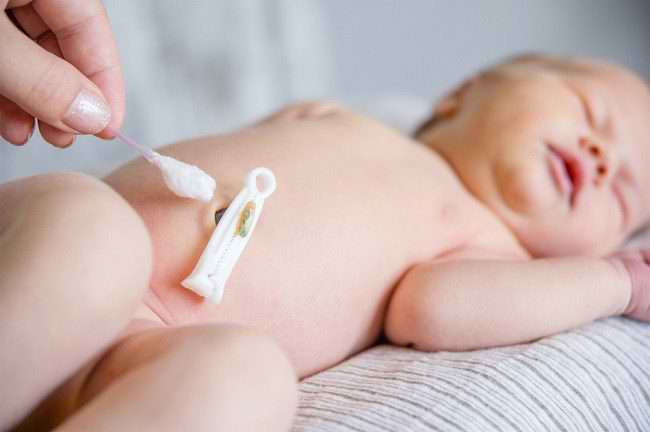 5 Cara Menjaga Kebersihan dan Merawat Tali Pusar Bayi - Alodokter