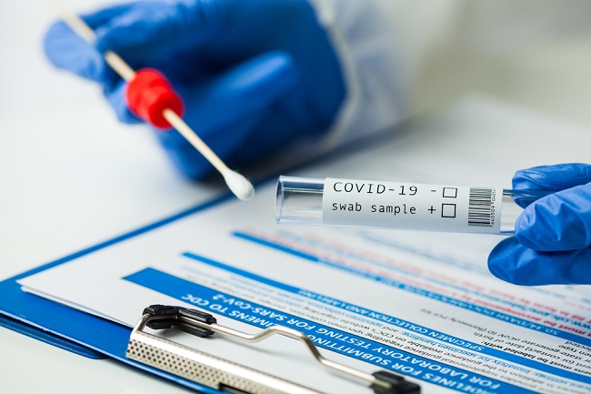 Mengenal CT Value dan Cara Membacanya - Alodokter