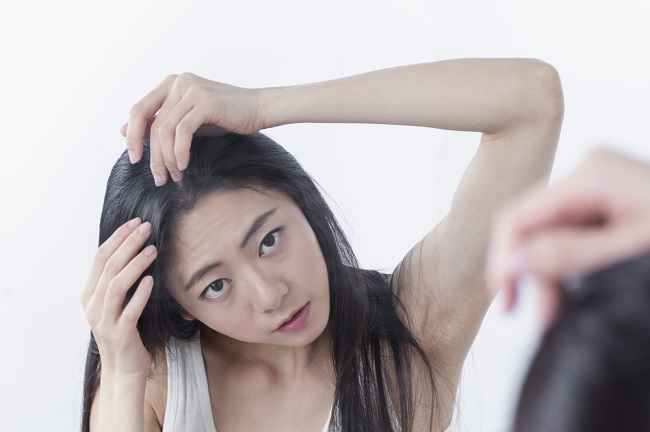 Cara Menghilangkan Kutu Rambut Dan Telurnya Alodokter 3360