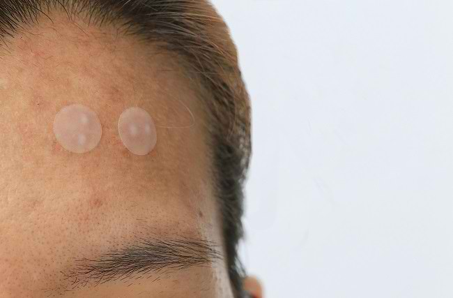 5 Acne Patch yang Efektif Menghilangkan Jerawat - Alodokter