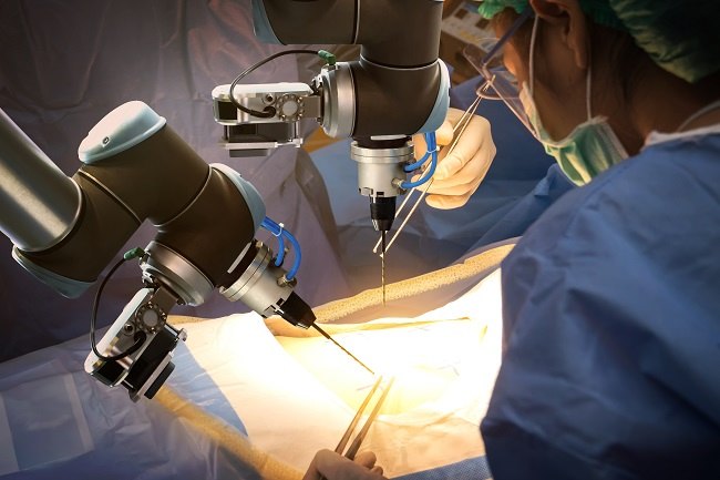 Ketahui Apa Itu Robotic Spine Surgery - Alodokter