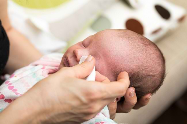 Kelopak Mata Merah Dan Bengkak Pada Bayi Robert Davies