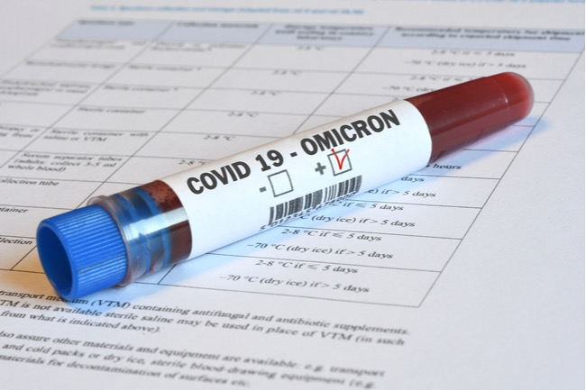 Know the Symptoms of Omicron Variants and How to Handle Them