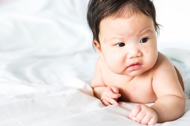 4 Tips Meminimalkan Risiko Kambuhnya Eksim pada Bayi - Alodokter