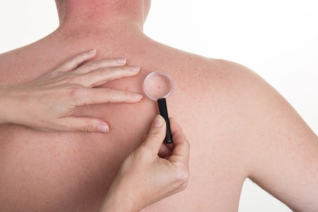 5 causes of lumps on the back and how to deal with them