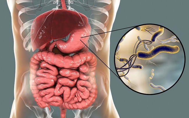 Helicobacter pylori Sumber: Y_tambe, Wikimedia commons, 2007.