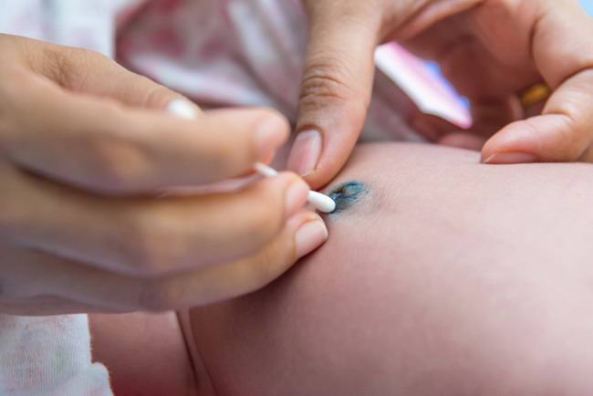 Cara Mencegah Pusar Bayi Berdarah - Alodokter