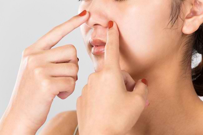 How to get rid of blackheads naturally for a smooth, radiant face - Alodokter