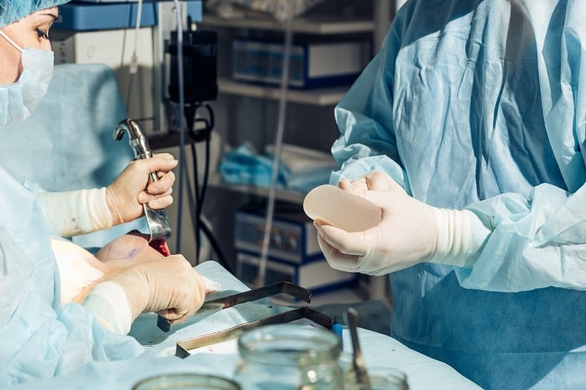 Operasi pengecilan payudara memengaruhi produksi ASI? ini faktanya