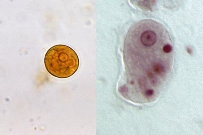 Sumber: Yasser, Wikimedia commons, 2008 (kiri); S Walkowski, Wikimedia commons, 2012 (kanan).