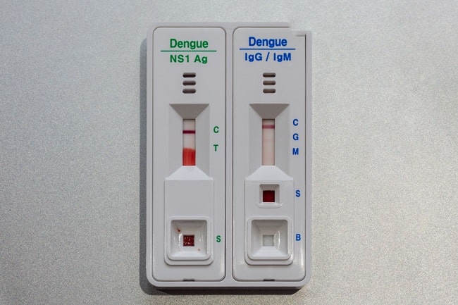 Pemeriksaan Ns1 Vs Igm Igg Untuk Diagnosis Dengue Alomedika