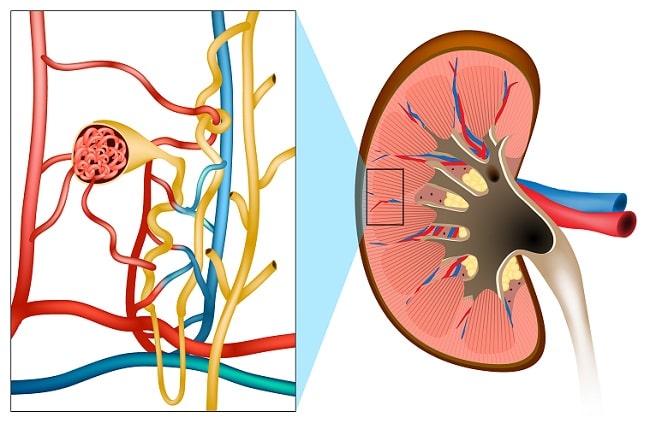 Diagnosis Sindroma Nefritik Alomedika