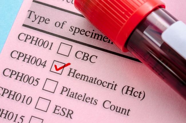 Level Hematokrit Rendah, Ini Penyebabnya - Alodokter