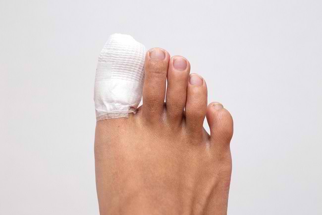 Here's How To Treat Ingrown Toenails