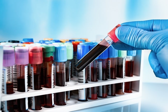 Pengumpulan Sampel Darah Untuk Pemeriksaan Laboratori