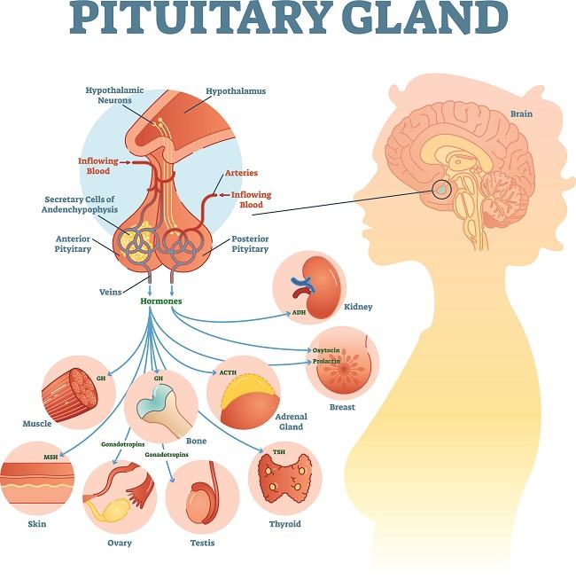 Empty Sella Syndrome - Alodokter