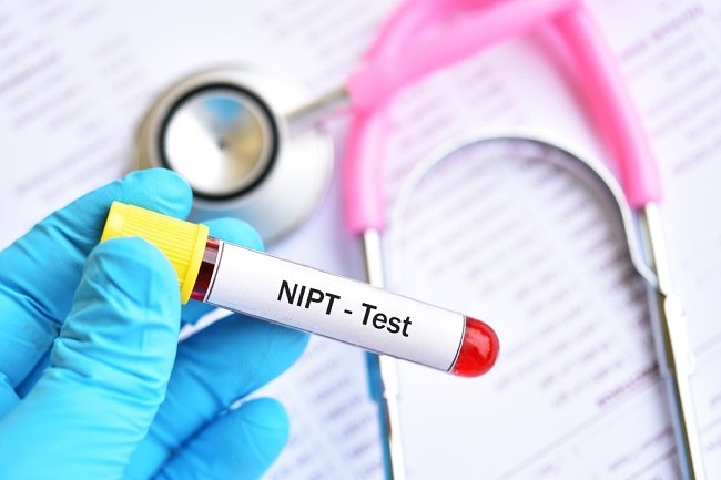 NIPT, Skrining Kelainan Bawaan pada Janin - Alodokter