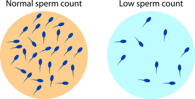Oligospermia - Alodokter
