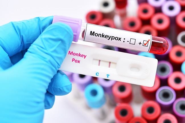 Monkeypox Enters Indonesia, Here Are the Prevention Steps