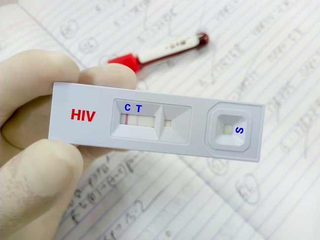 Mengenal Rapid Test HIV dan Efektivitasnya - Alodokter