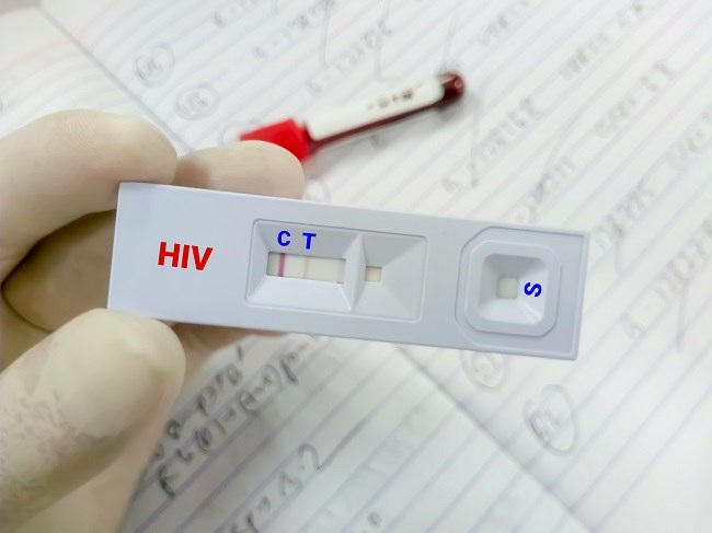 Mengenal Rapid Test Hiv Dan Efektivitasnya Alodokter 0269