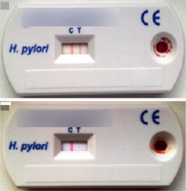 Tes Noninvasif Untuk Diagnosis Infeksi Helicobacter Pylori Alomedika